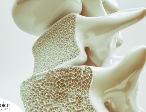 What Is Osteoporosis? Causes, Symptoms, and Treatments